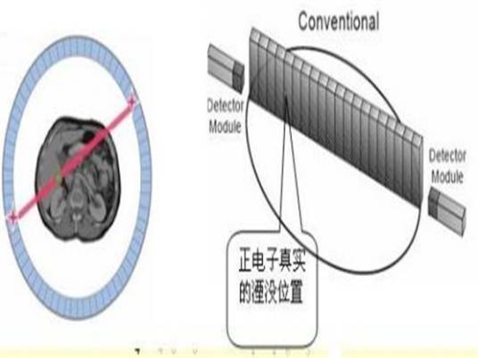 正电子湮没技术（核物理技术）